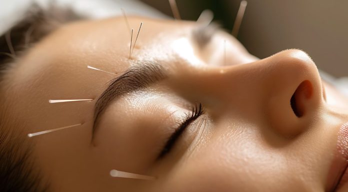 The Benefits of Acupuncture: How It Can Improve Your Health? The Benefits of Acupuncture How It Can Improve Your Health