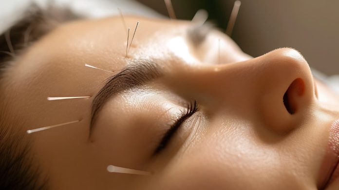The Benefits of Acupuncture How It Can Improve Your Health